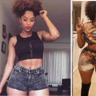 Shelah Maroe Plastic Surery (1)