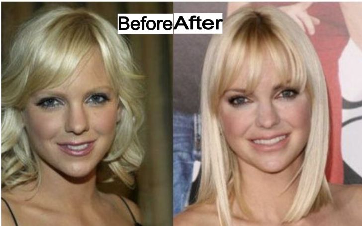 Every Details on Anna Faris Plastic Surgery: Before & After