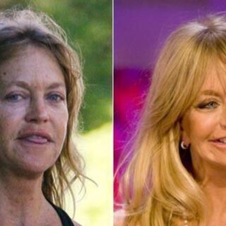 oldie Hawn's plastic surgery