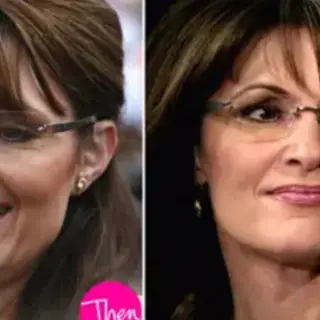 Sarah Palin Plastic Surgery - Facts with Before & After