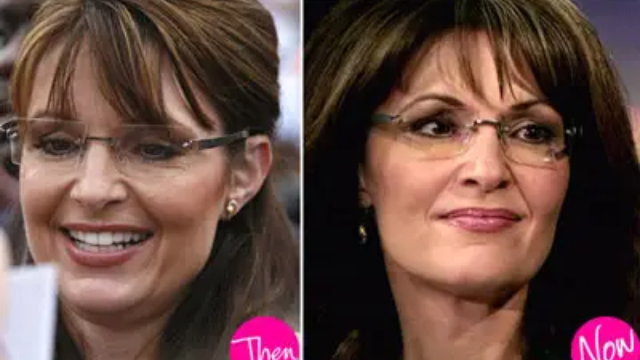 Sarah Palin Plastic Surgery - Facts with Before & After