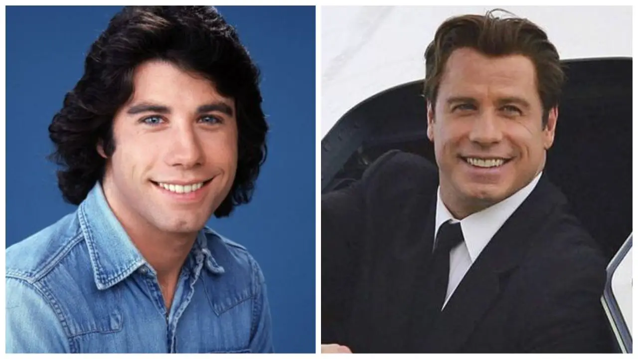 Did John Travolta Get Plastic Surgery? To Maintain His Youthful Appearance, the Saturday Night Fever Actor Continues to Have Plastic Surgery!