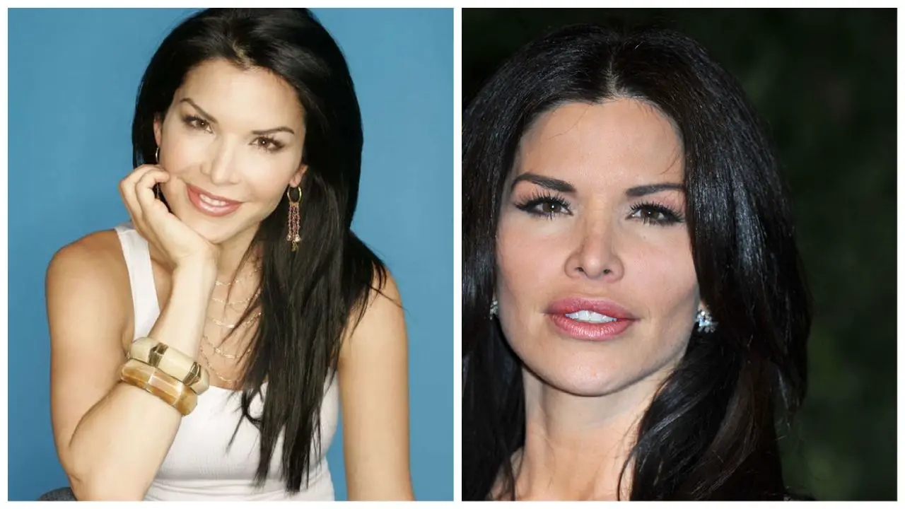Lauren Sanchez's Plastic Surgery: How Did She Look Before Going Under the Knife?