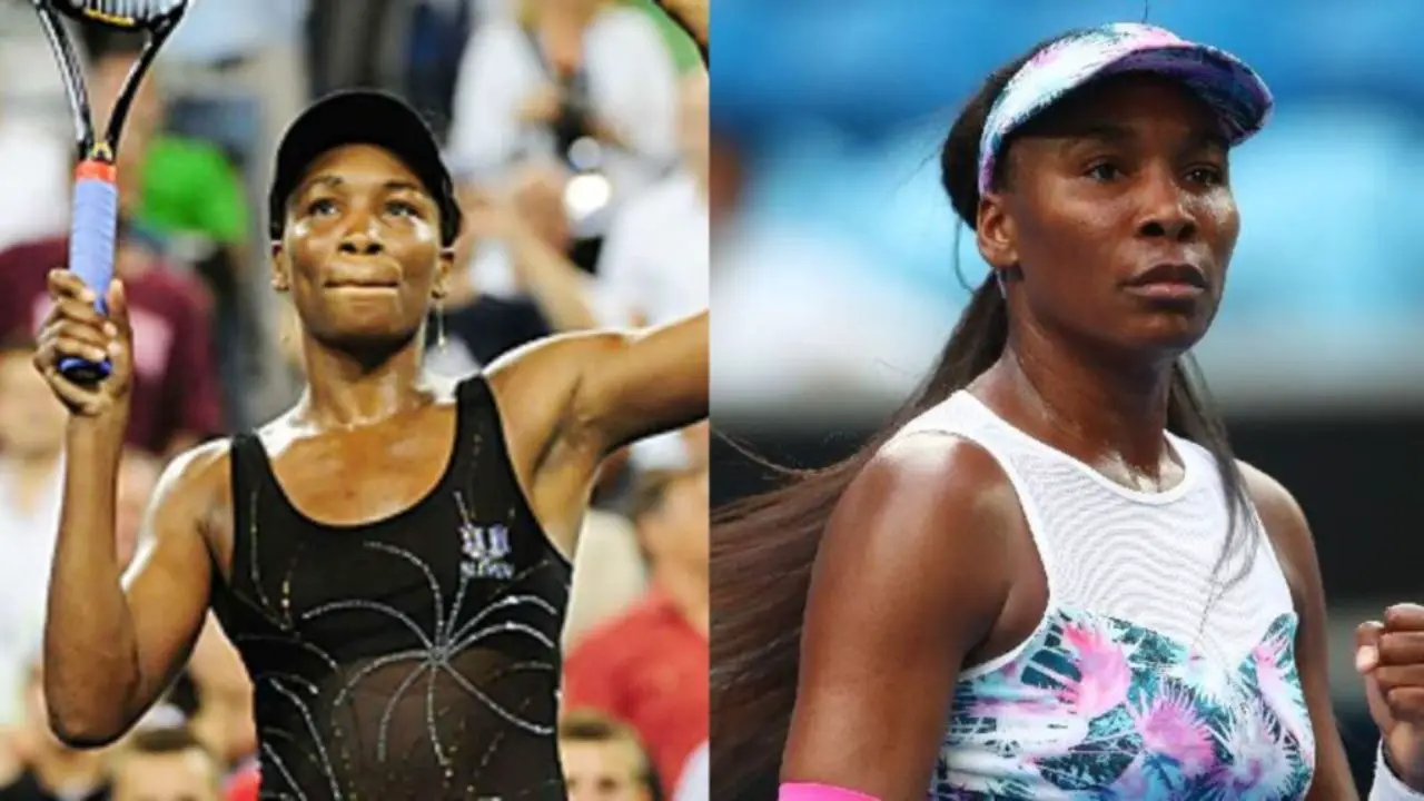 Venus Williams Plastic Surgery: What Happened to Her Face? Botox, Nose Job, Breast Implant, Buttocks Implant & More!
