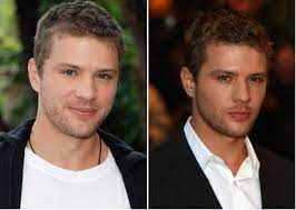 Ryan Phillippe Plastic Surgery - Before & After Facelift