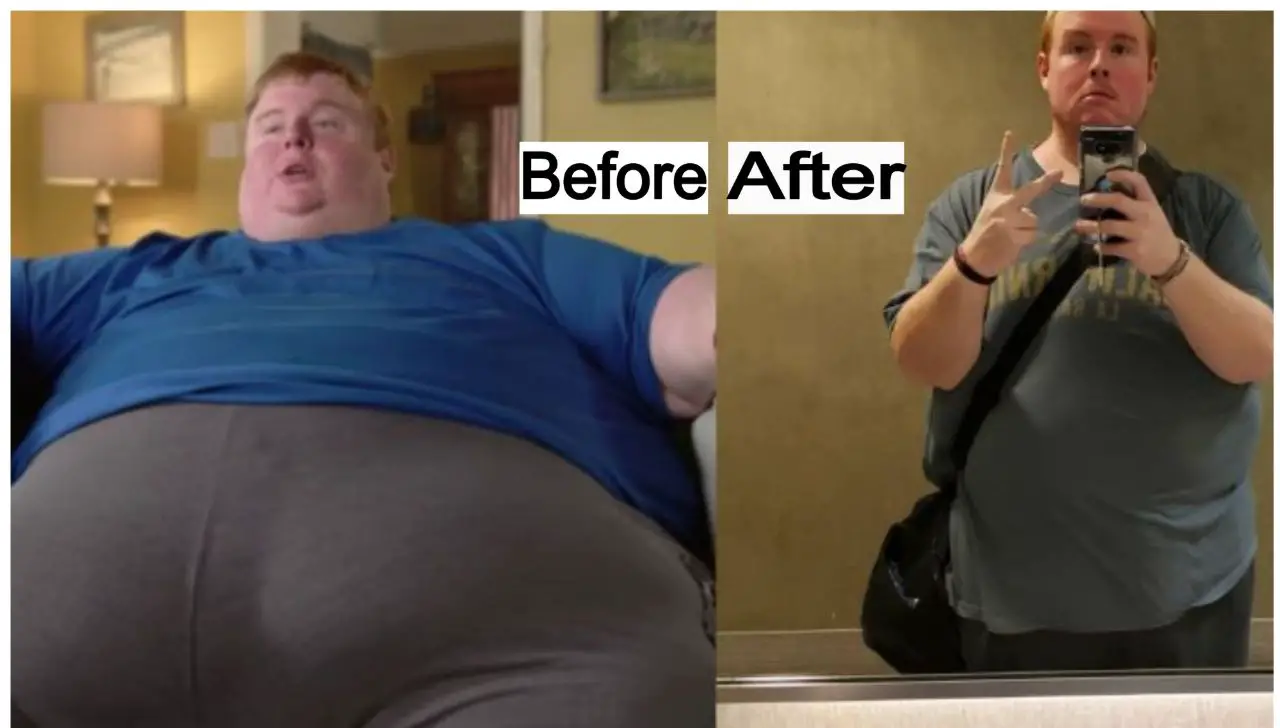 Casey King 400 Pound Weight Loss Before After 2022
