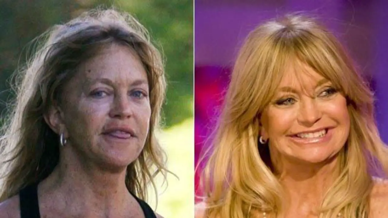 oldie Hawn's plastic surgery