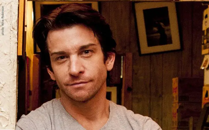 Andy Karl Plastic Surgery Facts