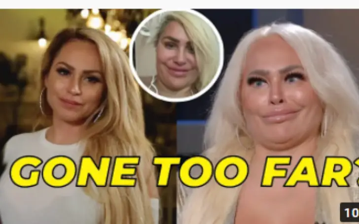 Darcey and Stacey's cosmetic surgery