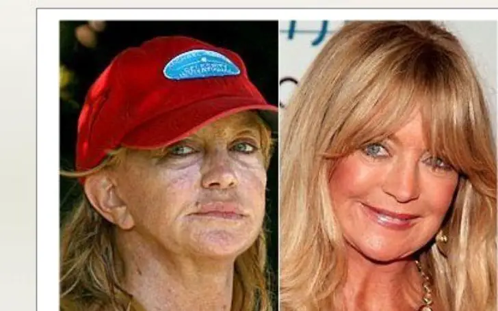 Goldie Hawn plastic surgery before and Afore