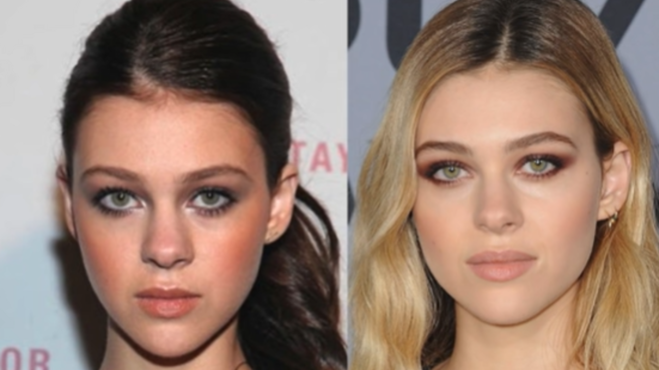Nicola Peltz Wiki, Plastic Surgery Before and After, rhinoplasty, lip fillers, jawline,chin procedures, Nose Job / Rhinoplasty, Lip Fillers, Jaw Line, chin.