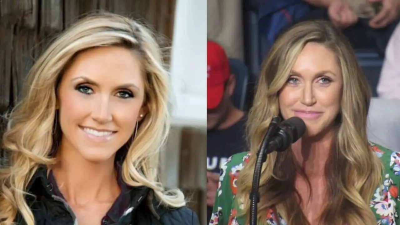 Lara Trump's Plastic Surgery Botox, Fillers & Botched Lip Job; Before