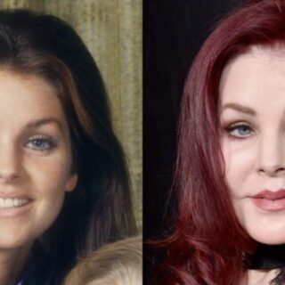Priscilla Presley’s Plastic Surgery: Elvis Presley’s Wife Was Labeled a ‘Plastic Surgery’ Addict Following a Botched Filler Procedure by Surgeon Dr. Daniel Serrano; How Does She Look Comparatively Young Now? Her Beauty Secrets Revealed!