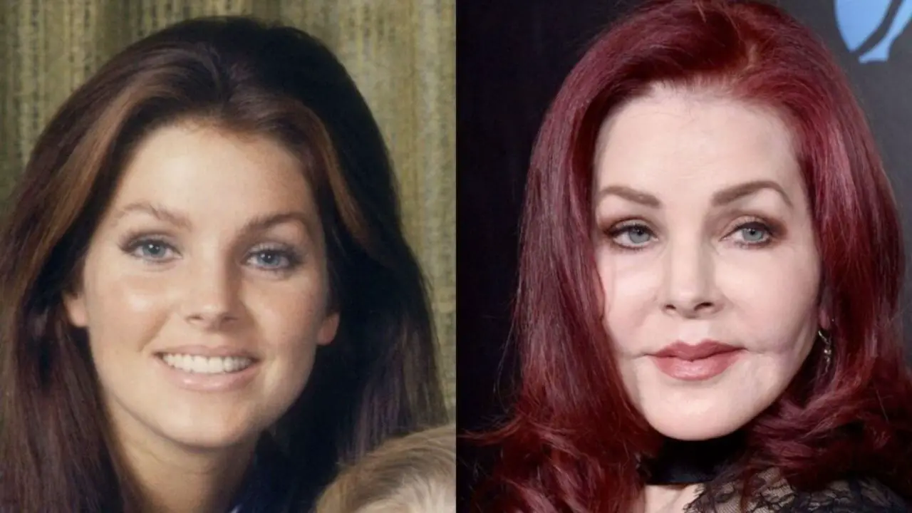 Priscilla Presley’s Plastic Surgery: Elvis Presley’s Wife Was Labeled a ‘Plastic Surgery’ Addict Following a Botched Filler Procedure by Surgeon Dr. Daniel Serrano; How Does She Look Comparatively Young Now? Her Beauty Secrets Revealed!